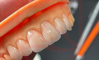 Wissden's 3D Multilayer Zirconia