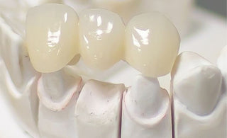 What Is a Zirconia Crown?