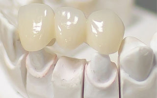 What Is a Zirconia Crown?