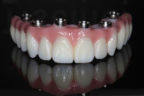 Exploring the Clinical Applications of Zirconia Crown