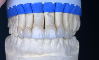 3D zirconia