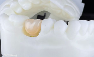 3D zirconia