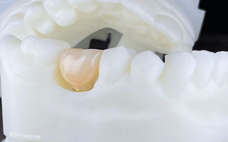 3D zirconia