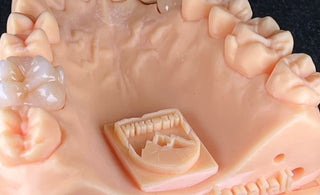 5 Key Factors in Choosing a Dental Crown Material