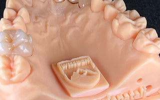 5 Key Factors in Choosing a Dental Crown Material