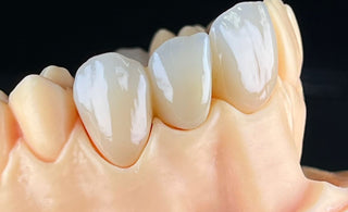 Influencing factors of aesthetic prosthesis performance of monolithic zirconia crowns