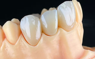 Influencing factors of aesthetic prosthesis performance of monolithic zirconia crowns