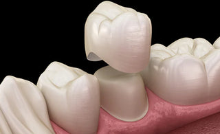 A Brief History of Dental Restoration