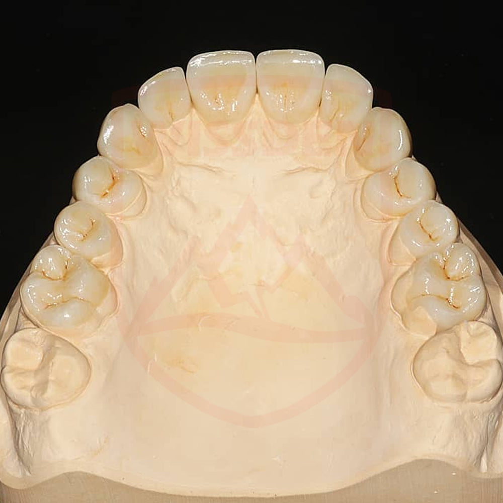 ST-C Pre-shaded Zirconia 98mm